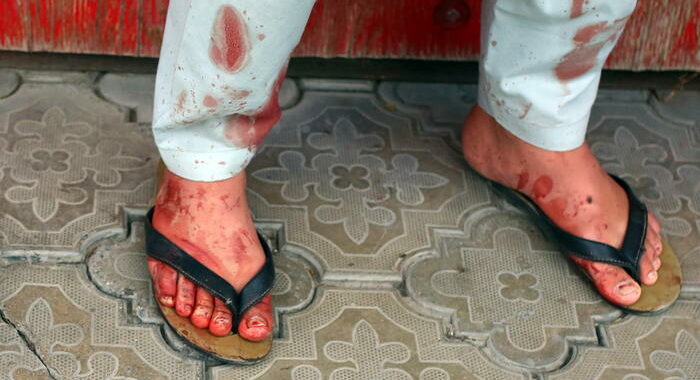 Afghanistan: Emergency, ‘abbiamo lavorato tutta la notte’